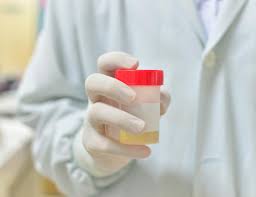 Gene Urine test